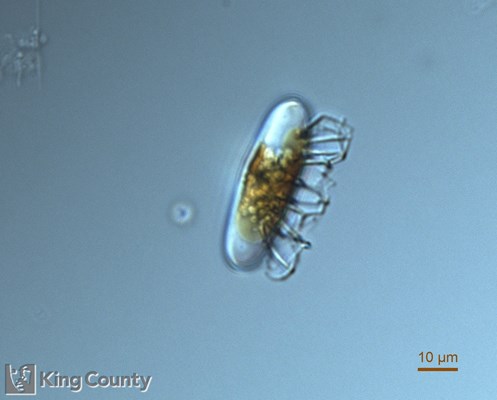 Photo of Chaetoceros diadema